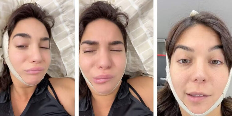 INFLUENCER LUCIANA MILESSI EXPERIMENTA PARÁLISIS FACIAL DESPUÉS DE CIRUGÍA ESTÉTICA