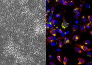 NUEVO MODELO CELULAR FACILITA LA INVESTIGACIÓN DE LA RELACIÓN ENTRE HERPES Y ALZHEIMER