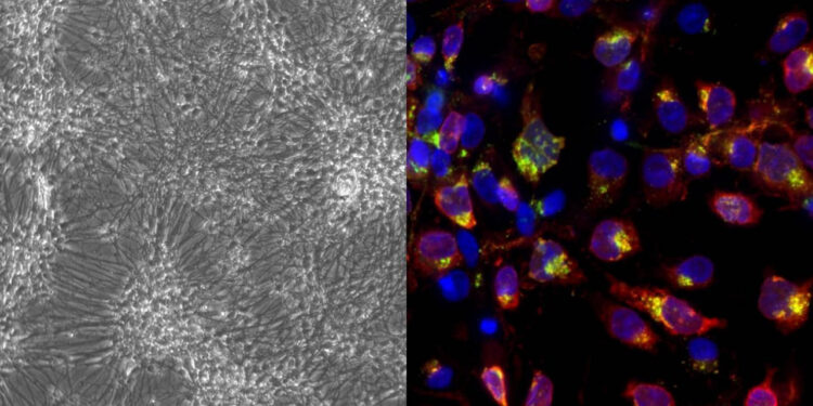 NUEVO MODELO CELULAR FACILITA LA INVESTIGACIÓN DE LA RELACIÓN ENTRE HERPES Y ALZHEIMER