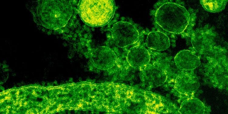 ALERTA EN EE. UU.: LA "BACTERIA DEVORADORA DE CARNE" ACECHA EN LAS AGUAS DEL GOLFO DE MÉXICO Y EL CARIBE 1 ALERTA EN EE. UU.: LA “BACTERIA DEVORADORA DE CARNE” ACECHA EN LAS AGUAS DEL GOLFO DE MÉXICO Y EL CARIBE