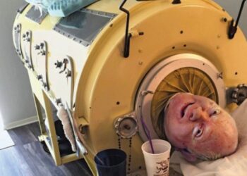 MUERE A LOS 78 AÑOS PAUL ALEXANDER, EL INSPIRADOR ‘HOMBRE DEL PULMÓN DE ACERO’