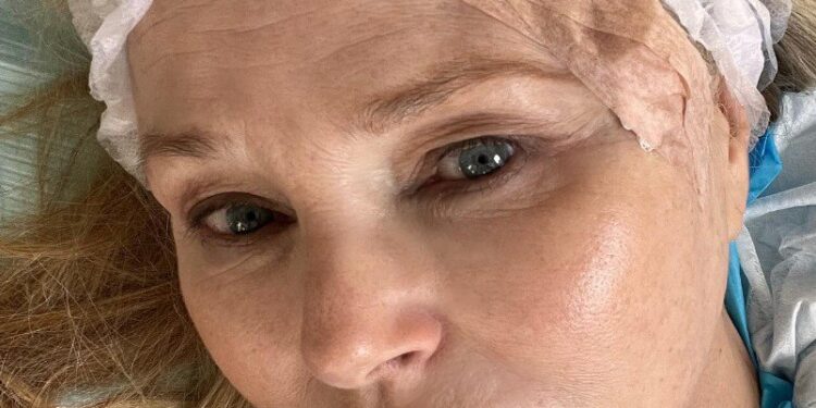 MODELO CHRISTIE BRINKLEY ADMITE SU LUCHA CONTRA EL CÁNCER DE PIEL