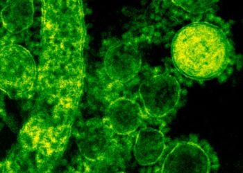 CONOCE LA SALMONELLA Y SUS SÍNTOMAS