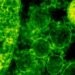 ALERTA EN JAPÓN: BACTERIA CARNÍVORA SE PROPAGA RÁPIDAMENTE 7 ALERTA EN JAPÓN: BACTERIA CARNÍVORA SE PROPAGA RÁPIDAMENTE