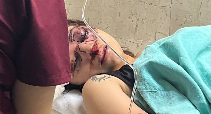 FAMILIA DE JOVEN AGREDIDA EN TAMAULIPAS PIDE AYUDA ECONÓMICA 1 FAMILIA DE JOVEN AGREDIDA EN TAMAULIPAS PIDE AYUDA ECONÓMICA