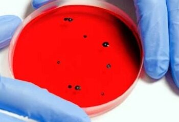 ALERTA SANITARIA POR KLEBSIELLA OXYTOCA EN EDOMEX