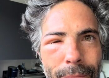 ROSTRO DE OSVALDO BENAVIDES GENERA PREOCUPACIÓN EN REDES