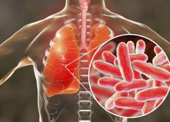 NUEVA YORK DECLARA EL FIN DEL BROTE DE LEGIONELOSIS PERO MANTIENE ALERTA SANITARIA