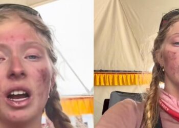 MUJER QUE ESCALÓ EL EVEREST RETORNA CON GRAVES SECUELAS FÍSICAS Y DESATA CRÍTICAS EN REDES