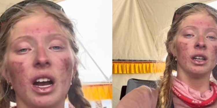 MUJER QUE ESCALÓ EL EVEREST RETORNA CON GRAVES SECUELAS FÍSICAS Y DESATA CRÍTICAS EN REDES 1 MUJER QUE ESCALÓ EL EVEREST RETORNA CON GRAVES SECUELAS FÍSICAS Y DESATA CRÍTICAS EN REDES