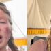 MUJER QUE ESCALÓ EL EVEREST RETORNA CON GRAVES SECUELAS FÍSICAS Y DESATA CRÍTICAS EN REDES