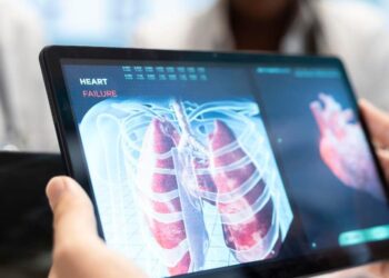 REVOLUCIÓN MÉDICA: DESARROLLAN PRUEBA DE TUBERCULOSIS QUE ELIMINA EL USO DE FLEMA
