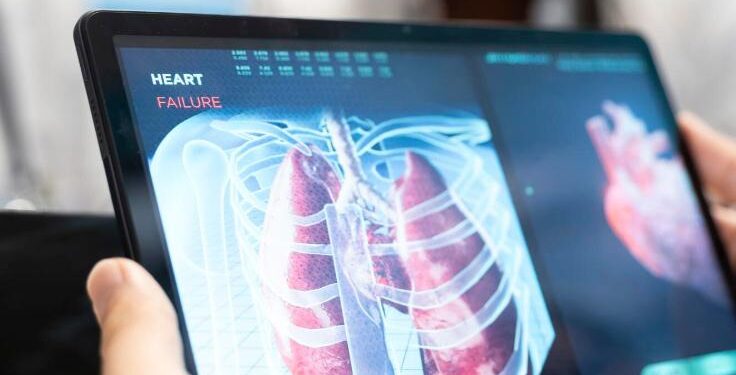 REVOLUCIÓN MÉDICA: DESARROLLAN PRUEBA DE TUBERCULOSIS QUE ELIMINA EL USO DE FLEMA