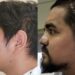 RECONSTRUYE IMSS NL ROSTRO A JOVEN CON TRIPLE CIRUGÍA Y TECNOLOGÍA DE VISUALIZACIÓN 3D 7 RECONSTRUYE IMSS NL ROSTRO A JOVEN CON TRIPLE CIRUGÍA Y TECNOLOGÍA DE VISUALIZACIÓN 3D